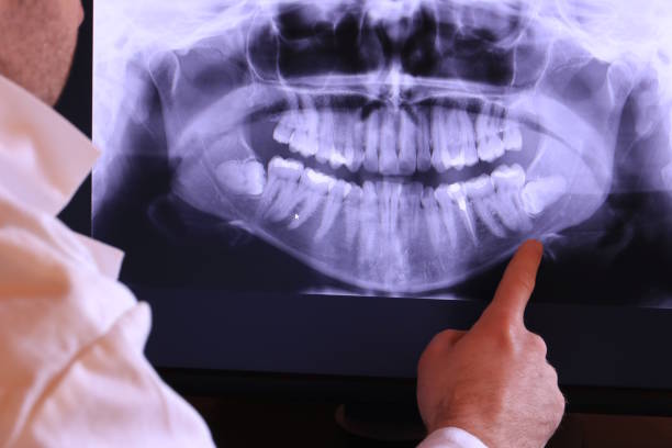 Best Emergency Treatment for Jaw Pain or Injury in Fairbury, IL
