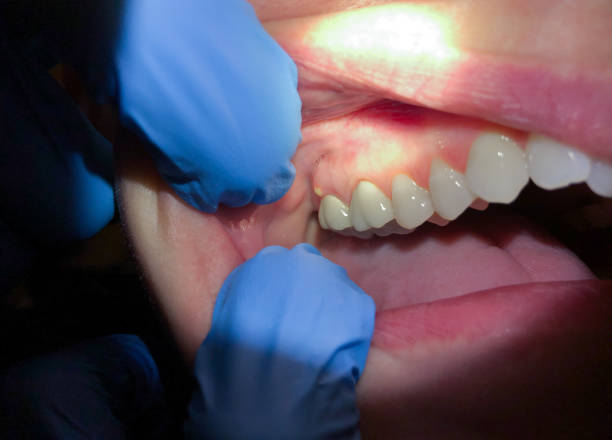 Best Emergency Cosmetic Dentistry (e.g., broken veneers) in Fairbury, IL
